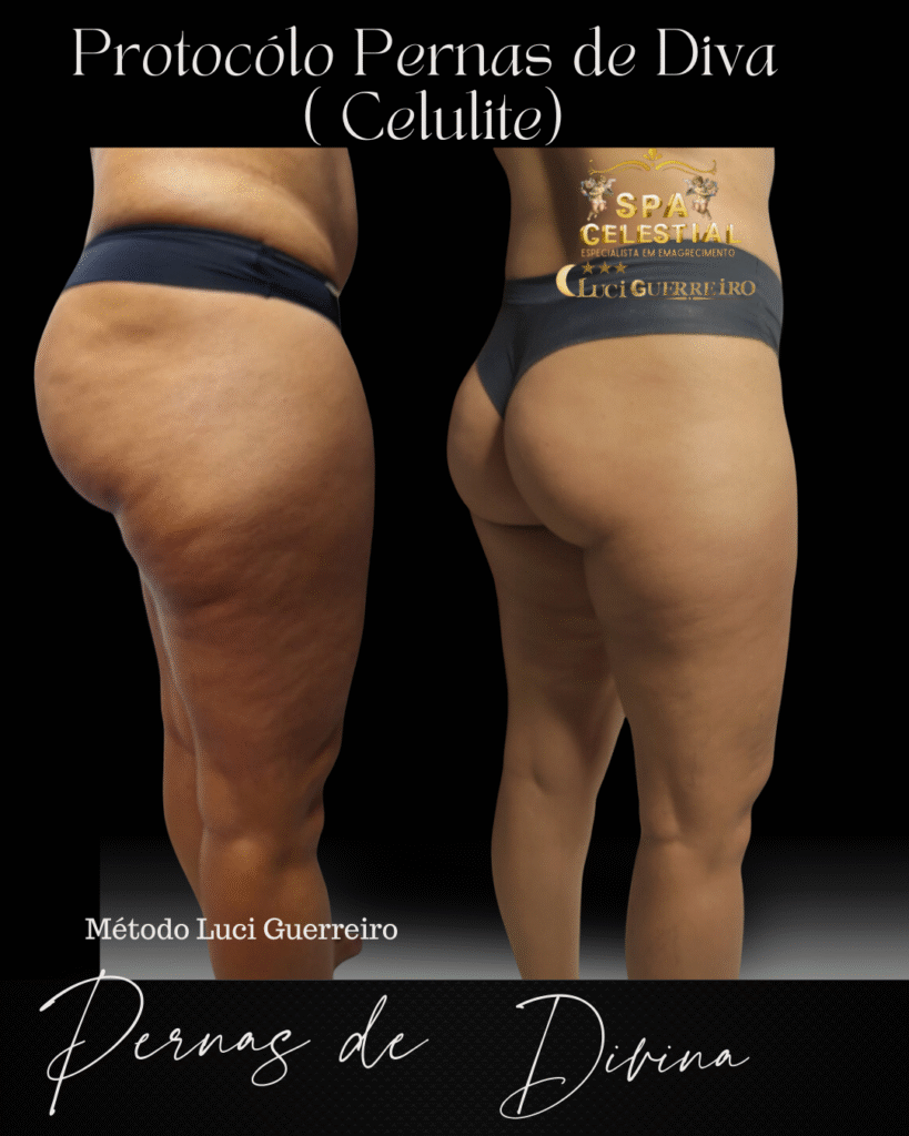 O que faz um (1080 x 1920 px) (9)